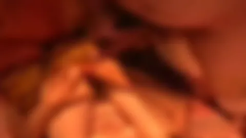 Hobbywixxer: Ich Spritze Sie an ..
