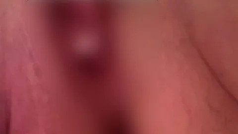Muschischleim